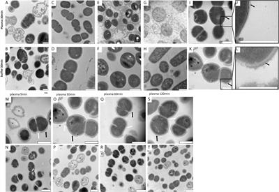 Plasma Protein Layer Concealment Protects Streptococcus pyogenes From Innate Immune Attack